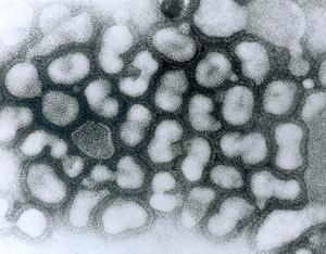 avian influenza