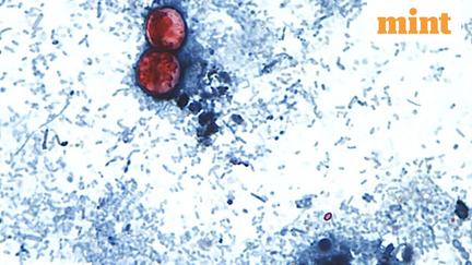Cyclospora Outbreak Sickens Hundreds in US