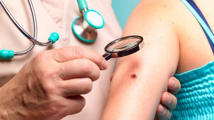 Moderna-Merck cancer vaccine trial succeeds