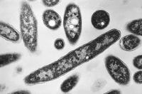 Second Death in NYC Legionnaires' Outbreak