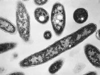 NYC Legionnaires' Outbreak Hits 60 Cases