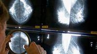 Breast Cancer Test Breakthrough