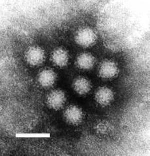 norovirus