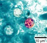 Cyclospora