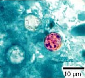 Cyclospora cayetanensis