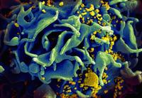 Norway Man Cured of HIV