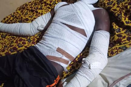 Amnesty: 100 killed in airstrike