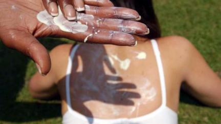 Melanoma cases hit UK record