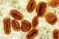 Scientists Smuggle Mpox Virus