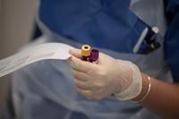 Alzheimer's Blood Test Breakthrough