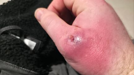 False widow spider population 'explodes'