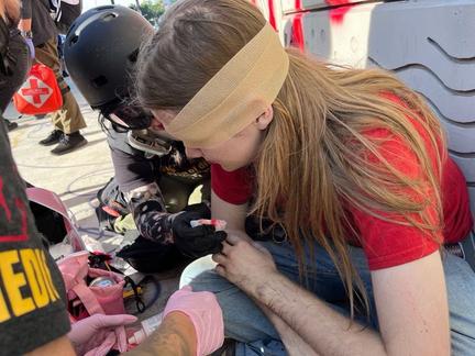 Texas student loses eye in protest