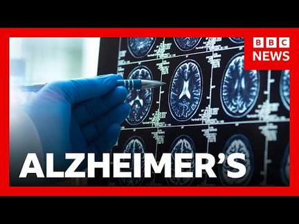 Alzheimer's Breakthrough Drugs Questioned